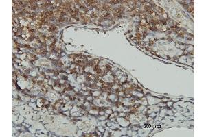 Immunoperoxidase of monoclonal antibody to STK16 on formalin-fixed paraffin-embedded human tonsil. (STK16 antibody  (AA 1-305))