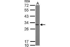 WB Image Sample (50 ug of whole cell lysate) A: mouse brain 12% SDS PAGE antibody diluted at 1:5000 (PSMA5 antibody  (Center))