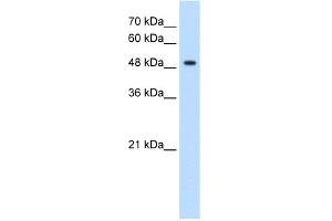 WB Suggested Anti-GLYCTK Antibody Titration:  1. (GLYCTK antibody  (N-Term))