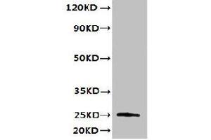 Western blot All lanes: TMED3 antibody at 6 μg/mL + MCF-7 whole cell lysate Secondary Goat polyclonal to rabbit IgG at 1/10000 dilution Predicted band size: 25, 20 kDa Observed band size: 25 kDa (TMED3 antibody  (AA 24-180))
