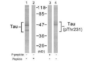Image no. 2 for anti-Microtubule-Associated Protein tau (MAPT) (Thr231) antibody (ABIN197266) (MAPT antibody  (Thr231))