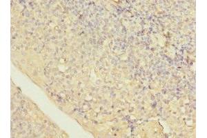 Immunohistochemistry of paraffin-embedded human tonsil tissue using ABIN7158438 at dilution of 1:100 (LITAF antibody  (AA 1-161))