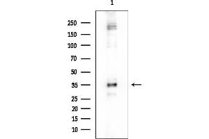 Western blot analysis of lysates from COLO205 cells, using PPA1 Mouse Monoclonal Antibody at 1/1000 dilution.