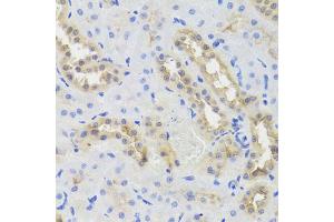 Immunohistochemistry of paraffin-embedded rat kidney using DISC1 antibody (ABIN5971500) at dilution of 1/100 (40x lens). (DISC1 antibody)