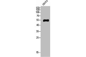 Western Blot analysis of SKOV3 cells using Glut4 Polyclonal Antibody (GLUT4 antibody  (N-Term))