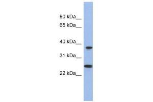 MTRF1L antibody used at 1 ug/ml to detect target protein. (MTRF1L antibody  (N-Term))