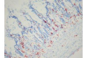 Image no. 3 for anti-Macrophages antibody (ABIN481699) (Macrophages antibody)