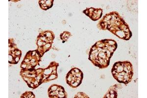 IHC image of ABIN7146866 diluted at 1:150 and staining in paraffin-embedded human placenta tissue performed on a Leica BondTM system. (CK1 epsilon antibody  (Isoform epsilon))