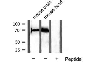 Western blot analysis of extracts of various sample,using HSC70 antibody.