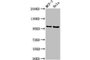 Western Blot Positive WB detected in: MCF-7 whole cell lysate, Hela whole cell lysate All lanes: NUP98 antibody at 3. (NUP98 antibody  (AA 965-1110))