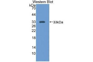 Western blot analysis of recombinant Mouse CS. (CS antibody  (AA 174-428))