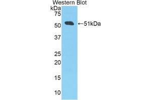 Detection of Recombinant APP, Human using Polyclonal Antibody to Amyloid Precursor Protein (APP) (APP antibody  (AA 672-711))