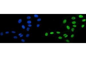 IF analysis of DBC-1/CCAR2 using anti-DBC-1/CCAR2 antibody (ABIN7602235). (CCAR2 antibody  (AA 65-917))