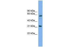 MITD1 antibody used at 1 ug/ml to detect target protein.