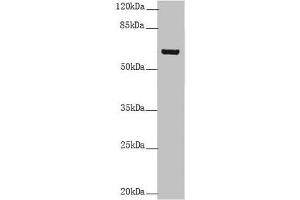 Western blot All lanes: KRT6B antibody at 5. (Keratin 6B antibody  (AA 1-280))
