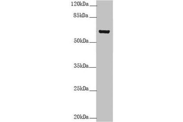 Keratin 6B antibody  (AA 1-280)