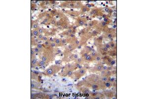 UBE2NL Antibody (N-term) (ABIN656527 and ABIN2845793) immunohistochemistry analysis in formalin fixed and paraffin embedded human liver tissue followed by peroxidase conjugation of the secondary antibody and DAB staining.