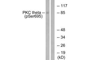 Western blot analysis of extracts from Jurkat cells, treated with EGF (200ng/ml, 15mins), using PKC theta (Phospho-Ser695) antibody.