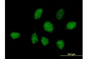 Immunofluorescence of purified MaxPab antibody to ZNF486 on HeLa cell. (ZNF486 antibody  (AA 1-216))