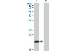 Western Blot analysis of NUMB expression in transfected 293T cell line by NUMB monoclonal antibody (M01), clone 4A7-A6. (NUMB antibody  (AA 1-135))