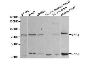 Western blot analysis of extracts of various cell lines, using GNAS antibody. (GNAS antibody)