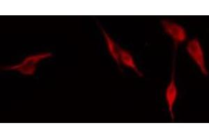 ABIN6276659 staining NIH-3T3 cells by IF/ICC. (CD44 antibody  (Internal Region))