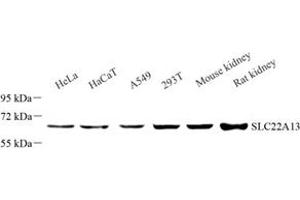 Western blot analysis of SLC22A13 (ABIN7075661) at dilution of 1: 1000 (SLC22A13 antibody)