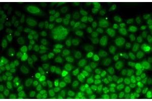 Immunofluorescence analysis of MCF7 cells using UFD1L Polyclonal Antibody (UFD1L antibody)