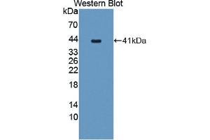 Detection of Recombinant PCSK5, Human using Polyclonal Antibody to Proprotein Convertase Subtilisin/Kexin Type 5 (PCSK5) (PCSK5 antibody  (AA 115-454))