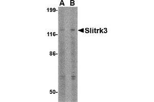 Western Blotting (WB) image for anti-SLIT and NTRK-Like Family, Member 3 (SLITRK3) (C-Term) antibody (ABIN1030683) (SLITRK3 antibody  (C-Term))