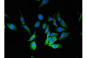 Immunofluorescence staining of Hela cells with ABIN7145343 at 1:133, counter-stained with DAPI. (Beclin 1 antibody  (AA 1-100))