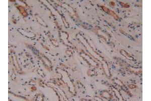 IHC-P analysis of Human Kidney Tissue, with DAB staining. (PTGS2 antibody  (AA 187-425))