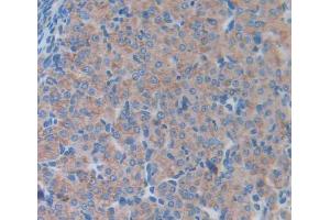 Used in DAB staining on fromalin fixed paraffin- embedded Kidney tissue (LCN5 antibody  (AA 28-187))