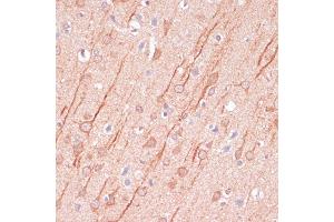 Immunohistochemistry of paraffin-embedded rat brain using DLG3 antibody (ABIN7266794) at dilution of 1:100 (40x lens). (DLG3 antibody  (AA 464-817))