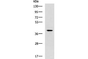 Western blot analysis of Mouse small intestines tissue lysate using TDP2 Polyclonal Antibody at dilution of 1:600 (TDP2 antibody)