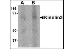 Western blot analysis of KINDLIN3 in rat spleen lysate with this product at (A) 1 and (B) 2 μg/ml. (FERMT3 antibody  (C-Term))