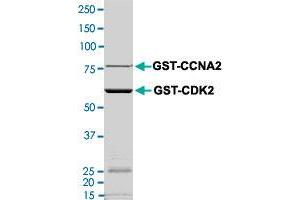 Image no. 1 for Cyclin-Dependent Kinase 2 (CDK2) (AA 1-298) (Active) protein (GST tag) (ABIN5569590) (CDK2 Protein (AA 1-298) (GST tag))