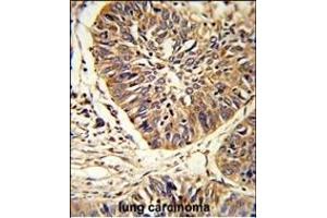Immunohistochemistry (Paraffin-embedded Sections) (IHC (p)) image for anti-Protein Disulfide Isomerase Family A, Member 3 (PDIA3) (AA 446-475), (C-Term) antibody (ABIN389464)