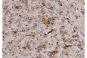 IHC analysis of MPPB/PMPCB using anti-MPPB/PMPCB antibody (ABIN7600758).