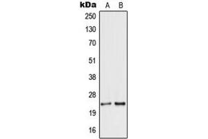 Western blot analysis of Secretogranin 5 expression in HEK293T (A), MCF7 (B) whole cell lysates. (SCG5 antibody  (Center))