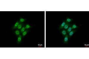 ICC/IF Image CMPK1 antibody [N1C3] detects CMPK1 protein at cytoplasm and nucleus by immunofluorescent analysis. (Cytidine Monophosphate (UMP-CMP) Kinase 1, Cytosolic (CMPK1) (Center) antibody)
