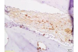 Formalin-fixed and paraffin embedded rabbit alveolar bone labeled with Anti-BMP7 Polyclonal Antibody, Unconjugated  at 1:200 followed by conjugation to the secondary antibody and DAB staining. (BMP7 antibody  (AA 293-350))