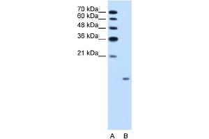 WB Suggested Anti-GCG Antibody Titration:  1. (Glucagon antibody  (N-Term))