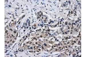 Immunohistochemical staining of paraffin-embedded Kidney tissue using anti-HDAC10mouse monoclonal antibody. (HDAC10 antibody)