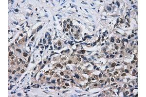 Immunohistochemical staining of paraffin-embedded Kidney tissue using anti-HDAC10mouse monoclonal antibody.