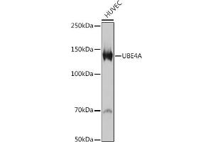Western blot analysis of extracts of HUVEC cells, using UBE4A antibody (ABIN7271190) at 1:1000 dilution. (UBE4A antibody)
