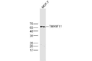 MCF-7 lysates probed with TM9SF1 Polyclonal Antibody, Unconjugated  at 1:300 dilution and 4˚C overnight incubation. (TM9SF1 antibody  (AA 51-150))