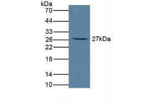 Detection of FcaR in Rat Serum using Polyclonal Antibody to Fc Fragment Of IgA Receptor (FcaR) (FCAR antibody  (AA 51-280))
