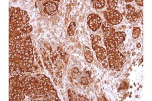 IHC-P Image Immunohistochemical analysis of paraffin-embedded SW480 xenograft, using CaMKIV, antibody at 1:500 dilution. (CAMK4 antibody)