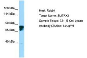 Image no. 1 for anti-SLIT and NTRK-Like Family, Member 4 (SLITRK4) (AA 661-710) antibody (ABIN6750228) (SLITRK4 antibody  (AA 661-710))